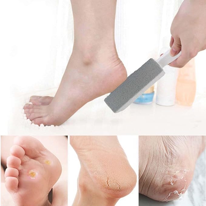 Pumice Stone for Toilet Cleaning with Handle Toilet Stone, Removing Hard Water Rings for Toilet Bowl Pool Bathtub, 4 Pack