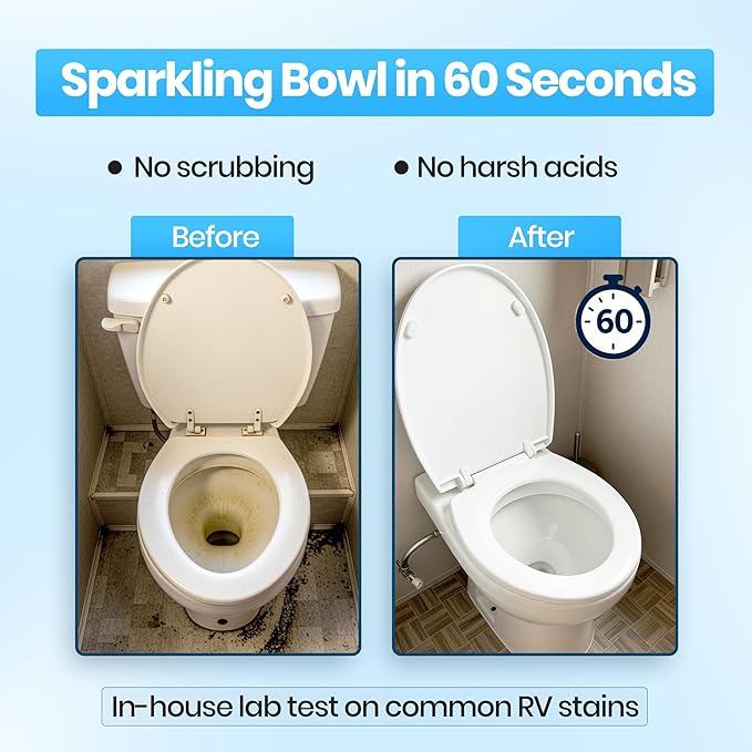 RV Toilet Bowl Cleaner with Easy Squirt Top – 5X Stronger Stain & Odor Eliminator – Sensor-Safe, Septic-Safe, Strong Formula, Rv Essentials, Made in USA (32 oz bottle)